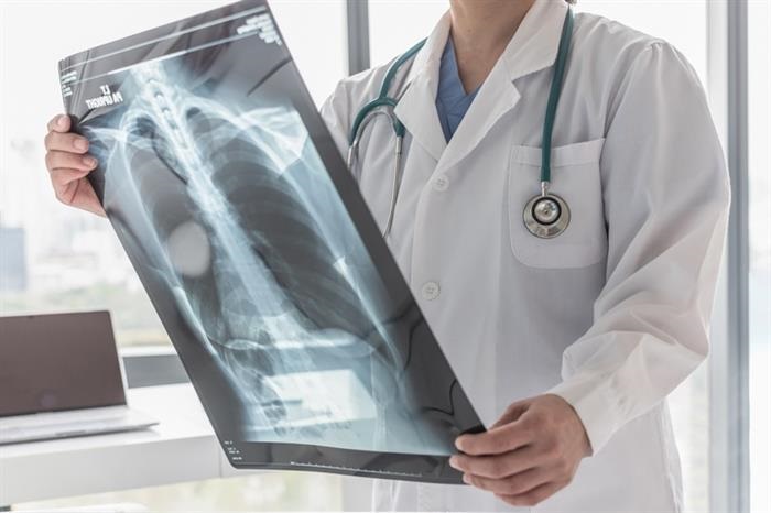 Check if you have osteoporosis